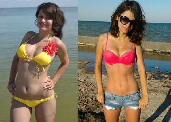 Anna is 10 kg afgevallen met NexaSlim
